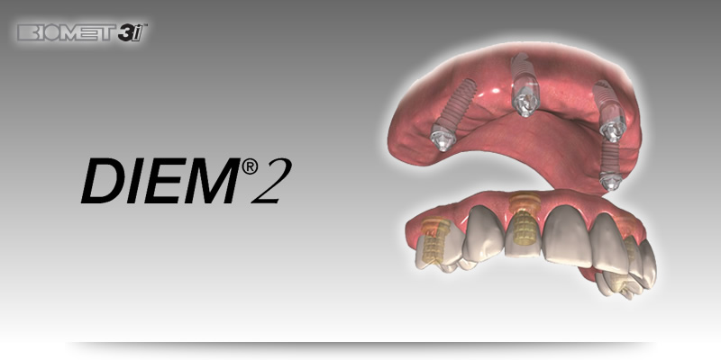 Biomet 3i 口腔种植系统